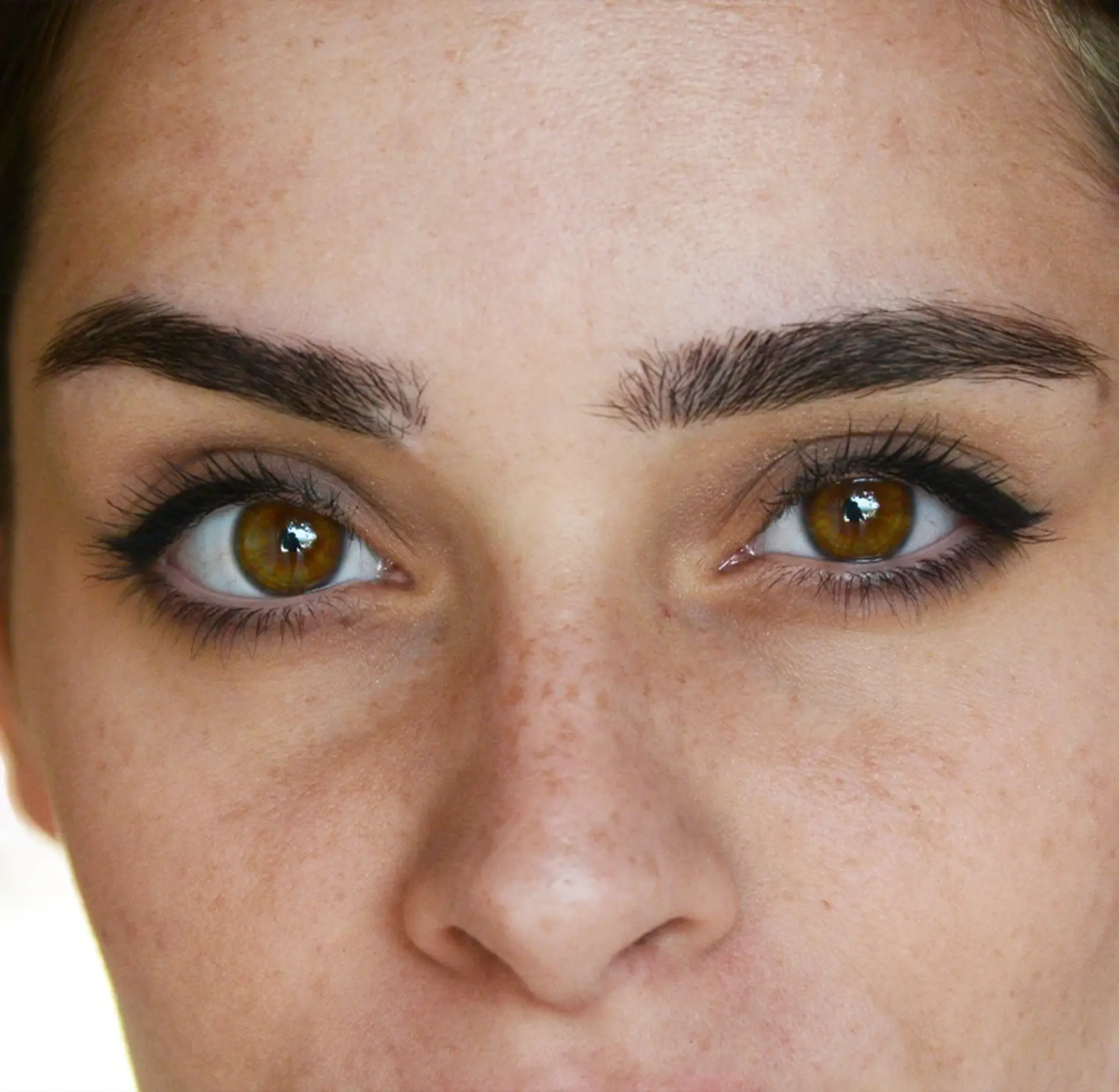 Under-eye rejuvenation treatment