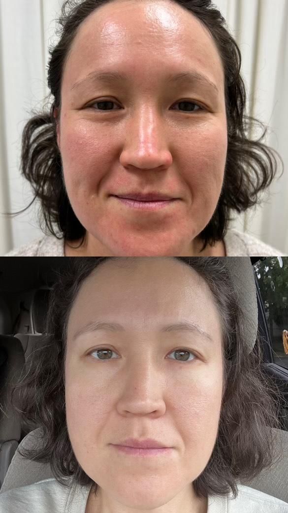 Blog Prodigy Peels Secret Revealing Smooth Skin Img2