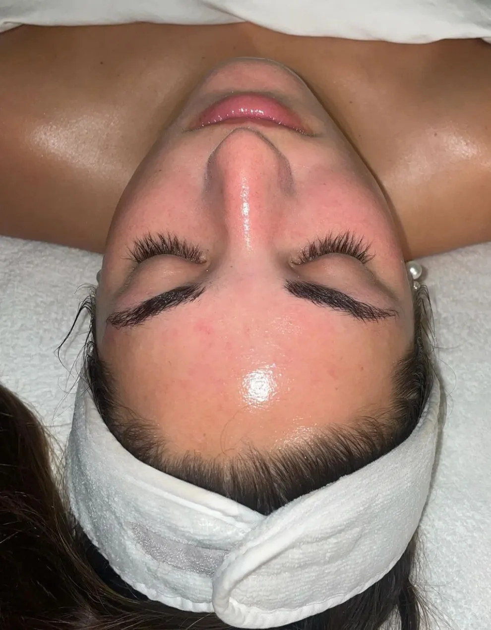 Blog Our Hottest Summer Treatments Img4