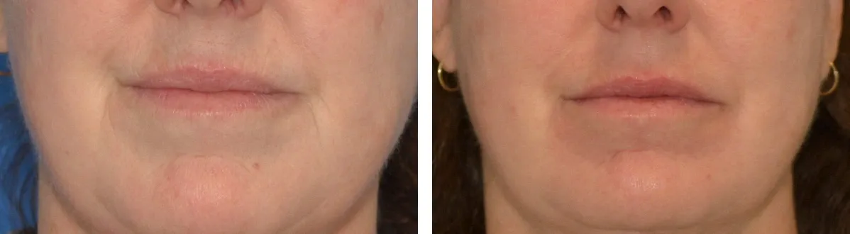 Blog How Treat Skin Crepiness Img4