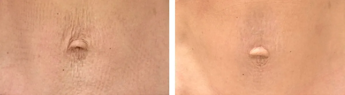 Blog How Treat Skin Crepiness Img3