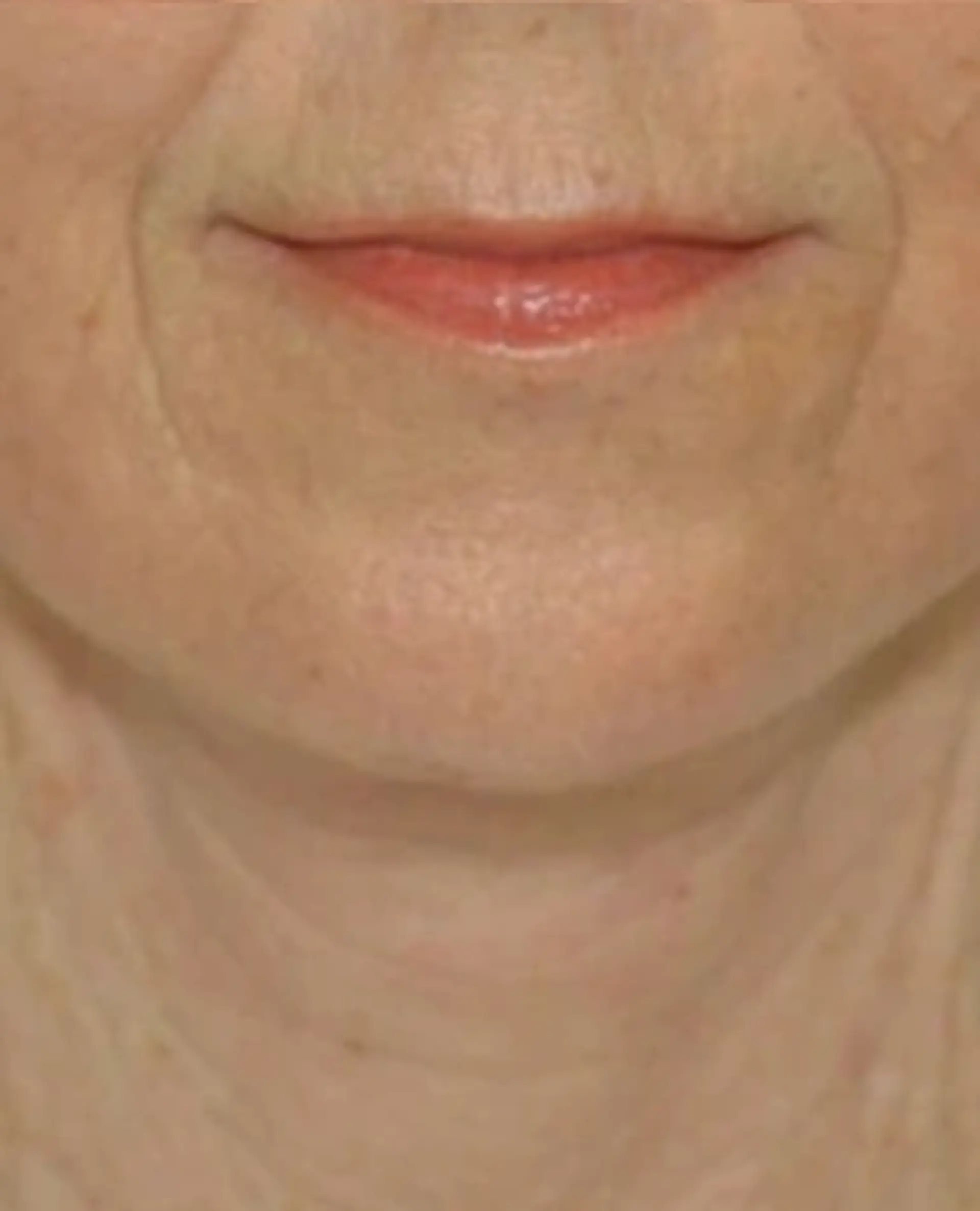 Before Facial Plastic Surgery Before and After Photos